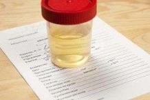 Urine Color Chart Tells You About Your Health Status