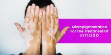 Best Vitiligo Micropigmentation Treatment in Delhi | Look Young Clinic
