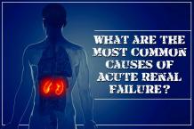 What are the Most Common Causes of Acute Renal Failure?