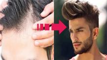 What can I do to Stop my Hair from Thinning? - American Article