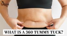 What is A 360 Tummy Tuck?