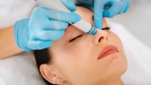 Is HydraFacial the Best Way to Treat Acne Scars?