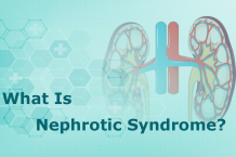 What is nephrotic syndrome?