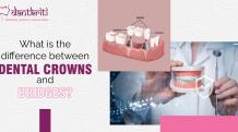 What Is The Difference Between Dental Crowns And Bridges?