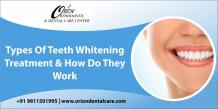 Teeth Whitening Cost In India | How Long Does Teeth Whitening Last | Update Cost List 2024