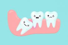 Wisdom Tooth Pain: Symptoms, Causes, Remedies &amp; Relief | Smile Oracles