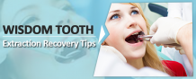 Wisdom Tooth Extraction Recovery Tips By Best Dentist in Pune