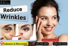 Look Younger with Wrinkle Reduction Treatment in Culpeper &#8211; divyatyagi