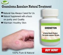 How to Treat Granuloma Annulare with Natural Remedies?