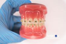 Adult Orthodontics Near Me | Orthodontist for Adults Near Me in Miami
