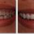 Aesthetic Dental Expert New York City Can Assist You Accomplish Your Objectives... &mdash; best invisaligsn in Manchester