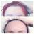 Melbourne Anti-Wrinkle Injections | Dr. Green Cosmetic Group