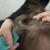 Tips To Easily Prevent And Control Head Lice &#8211; MDXConcepts