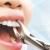 Home - Local Emergency Dentist  - Enjin - What Do You need to Know About Wisdom Tooth Extraction?