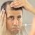 What to Do If Your Hair Transplant Treatment Failed?