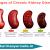 Why is Ayurvedic kidney treatment better?