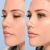 If you&#39;re interested, then perhaps get in call with a business using Botox... &mdash; doctors aesthetic courses sites