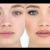 Semi Permanent Makeup in Dubai &amp; Abu Dhabi | Dynamic Clinic