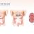 Colorectal Surgeon: Specialized in Treating Lower Digestive Tract