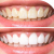 Best Cosmetic Dentist in Mumbai - Dr. Ashwadhi's Aesthetic Dentistry