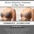 Best and affordable breast reduction surgery treatment in Cape Town