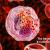 The Basics of Hematology &amp; Common Blood Disorders | Onco Life Hospital