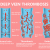 Deep Vein Thrombosis, DVT Treatment | Dr. Raghu