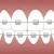 Dental Braces – Complete Solution for a Healthy Smile & Much More