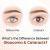 What’s the Difference between Glaucoma and Cataracts | Dr. Jeevan Ladi