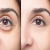 All About Removing Lower Eye Bags
