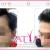 FUE Hair Transplant Clinic, Cheap Fue treatment cost in Delhi, India