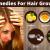 What Causes Hair Loss In Teenagers &amp; What Are Natural Remedies For Hair Growth - joonse