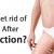 How To Get Rid Of Lumps After Liposuction?