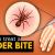 How to Treat a Jumping Spider Bite: A Complete Guide - Xanaxcart