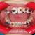 Types of Adult Braces Available - good-orthodontist-nearby.over-blog.com