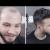 Cost effective hair replacement for men