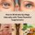 How to Eliminate Eye Bags Naturally with These Powerful Supplements - Dubai Entertainment