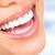 Best Teeth Whitening Treatment in Delhi | Coral Dental