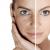 Melasma Treatment in Hyderabad¬-Cream for Melasma Treatment