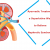 Ayurvedic treatment a superlative way to relieve Nephrotic Syndrome