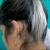 Premature Graying Treatment - Dr. Health Clinic - Homepage