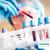 Private Blood Tests Centre in BexleyHeath, Kent