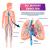 What is Pulmonary Embolism, Symptoms and Treatment?