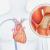 robotic mitral valve surgery