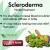 Natural Remedies for Scleroderma to Treat Painful Joints