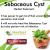 Natural Remedies for Sebaceous Cyst Include Some Foods to Eat or Avoid