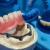 Affordable Dental Implant Ohio | Emergency Dental Service