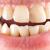 Everything You Should Know About Periodontal Disease