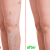 Varicose Veins Laser Treatment | Vascular Veins Specialist in Hyderabad