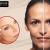 Voluma New Jersey,Facial treatment New Jersey